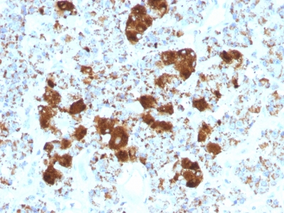 FFPE human pituitary sections stained with 100 ul anti-ACTH (clone SPM501) at 1:300. HIER epitope retrieval prior to staining was performed in 10mM Citrate, pH 6.0.